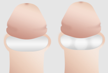 원본 원고 그림 7: 대체 설명 검토 필요