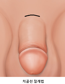 원본 원고 그림 2: 대체 설명 검토 필요