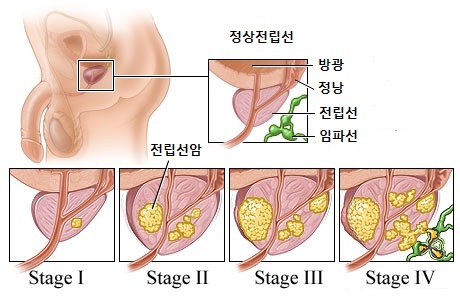 원본 원고 그림 4: 대체 설명 검토 필요