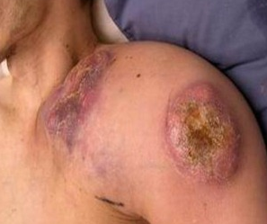 원본 원고 그림 13: 대체 설명 검토 필요