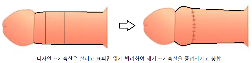 원본 원고 그림 1: 대체 설명 검토 필요