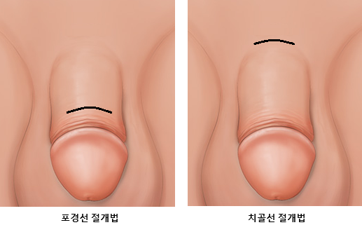 원본 원고 그림 4: 대체 설명 검토 필요