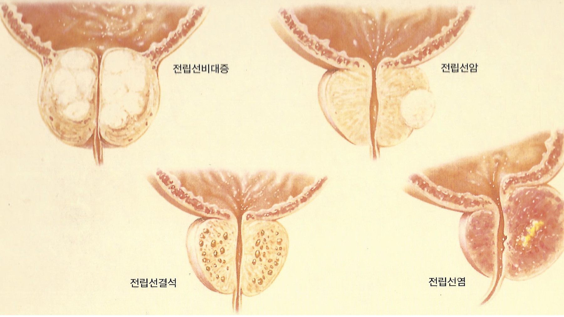 원본 원고 그림 2: 대체 설명 검토 필요